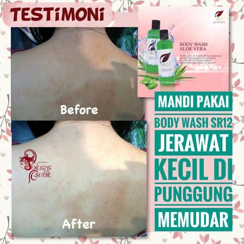 Body Wash SR12 Sabun Mandi Cair Penghilang Jerawat Punggung Pencerah Kulit Perontok Daki BPOM