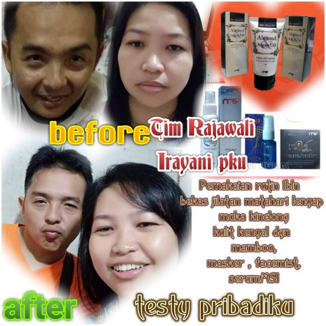Bamboo charcoal aman bumil busui bayi bpom berat 100gram bau badan eksim kutuan botak ketombe
