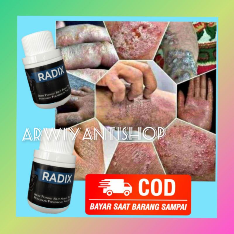 (COD) RADIX OBAT KULIT EXIM 3x DI OLES 7 HARI HILANG PERMANEN SEGALA MACAM EXIM, KORENG DLL