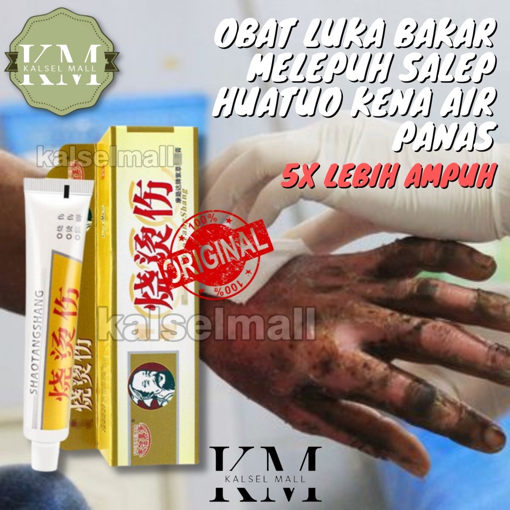 Obat Salep Krim Luka Bakar Melepuh Kutil Kunat Original 100% Huatuo Herbal Tradisional Cina Kena Air Panas Terkena Api Kulit  Menghilangkan Ampuh Keloid OC7