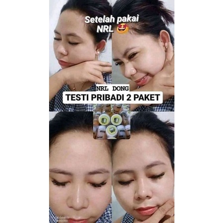 Nrl kosmetik