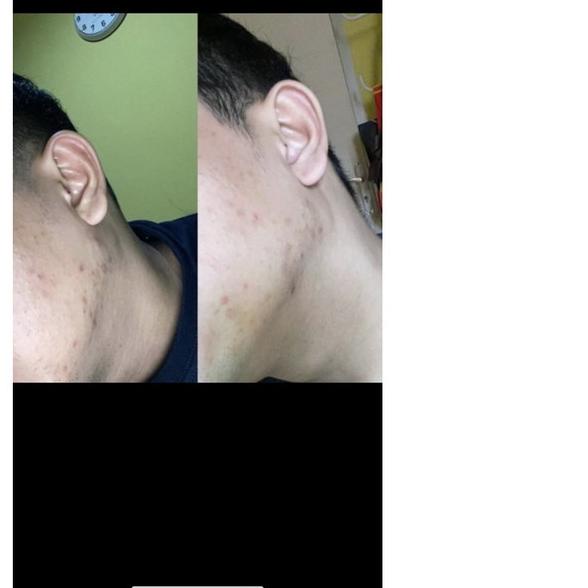 ☇ NEW FW WHITENING Premium sabun facial wash brightening scrub aha arbutin bpom krim farma dokter