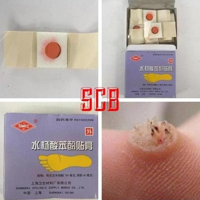 TERLARIS Obat Cina Plester Obat Kutil / Ji Yan Gao / Mata Ikan / Kapalan Murah