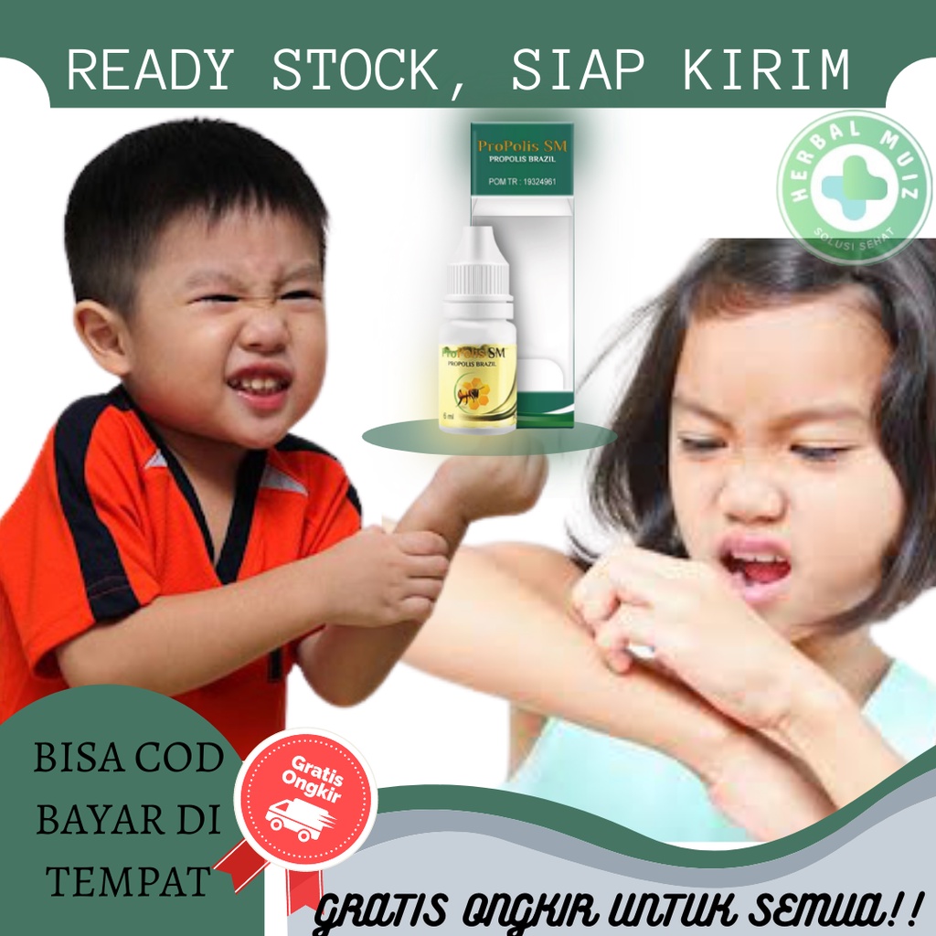 Obat Gatal Alergi Anak, Obat Gatal Kulit Melepuh Karena Alergi, Obat Gatal Alergi Debu - PROPOLIS SM
