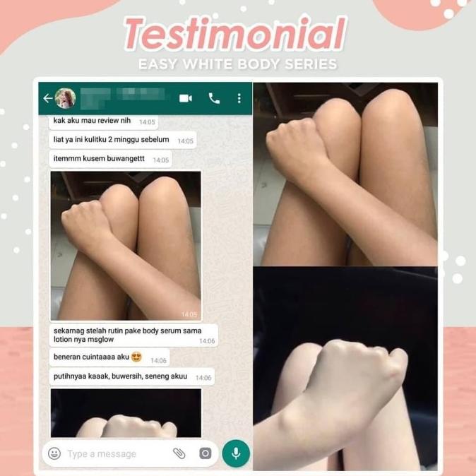 MS GLOW EASY WHITE BODY SERIES MS GLOW BODY LOTION BODY SERUM PEMUTIH