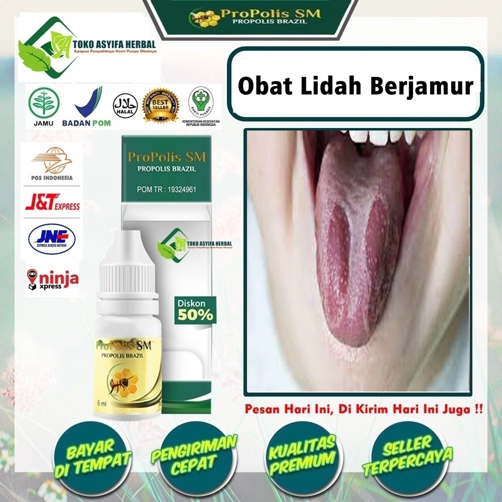 Obat Lidah Berjamur