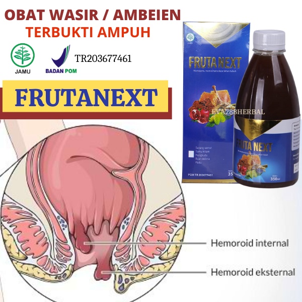 Obat wasir paling ampuh Frutanext herbal atasi wasir ambeien dengan cepat tanpa operasi