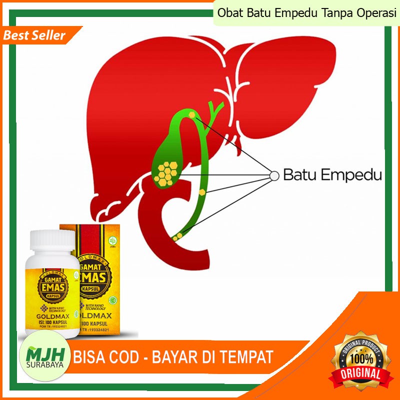 Obat Batu Empedu Tanpa Operasi - Penghancur Batu Empedu - Penghilang Batu Empedu/Sakit Perut