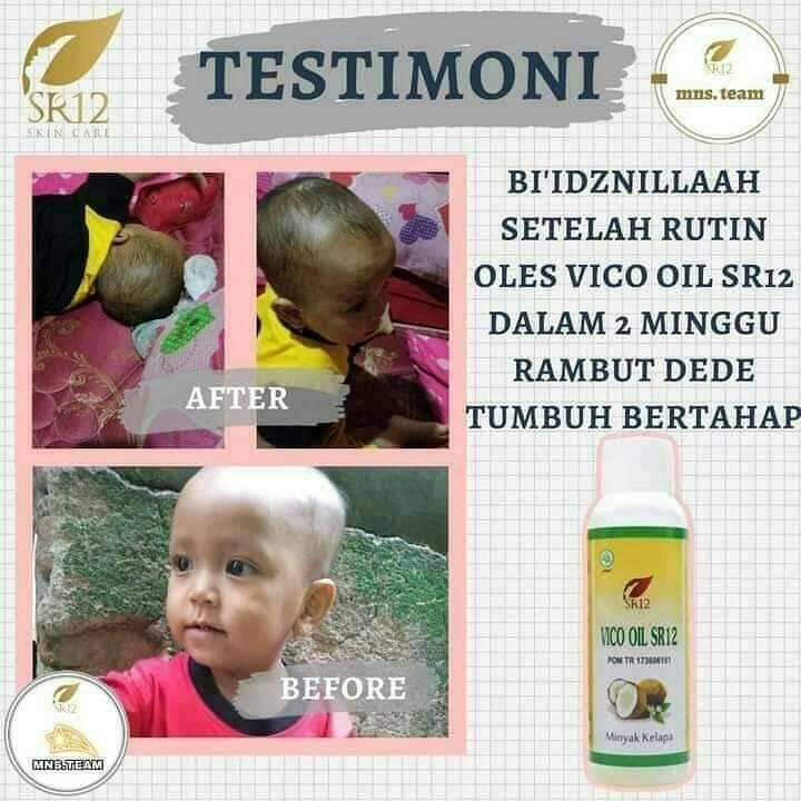 Penumbuh Rambut - Pelebat Rambut Alami