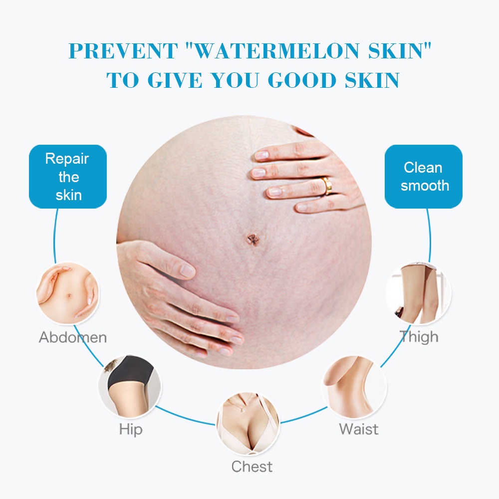 Anti Stretch Mark Cream AICHUN BEAUTY Stretch Mark Removal Bekas Luka Perbaikan Cream Stretch Mark Removal Perawatan Bekas Luka 60g body lotion, pelembab kulit, menghidrasi dan mengangkat