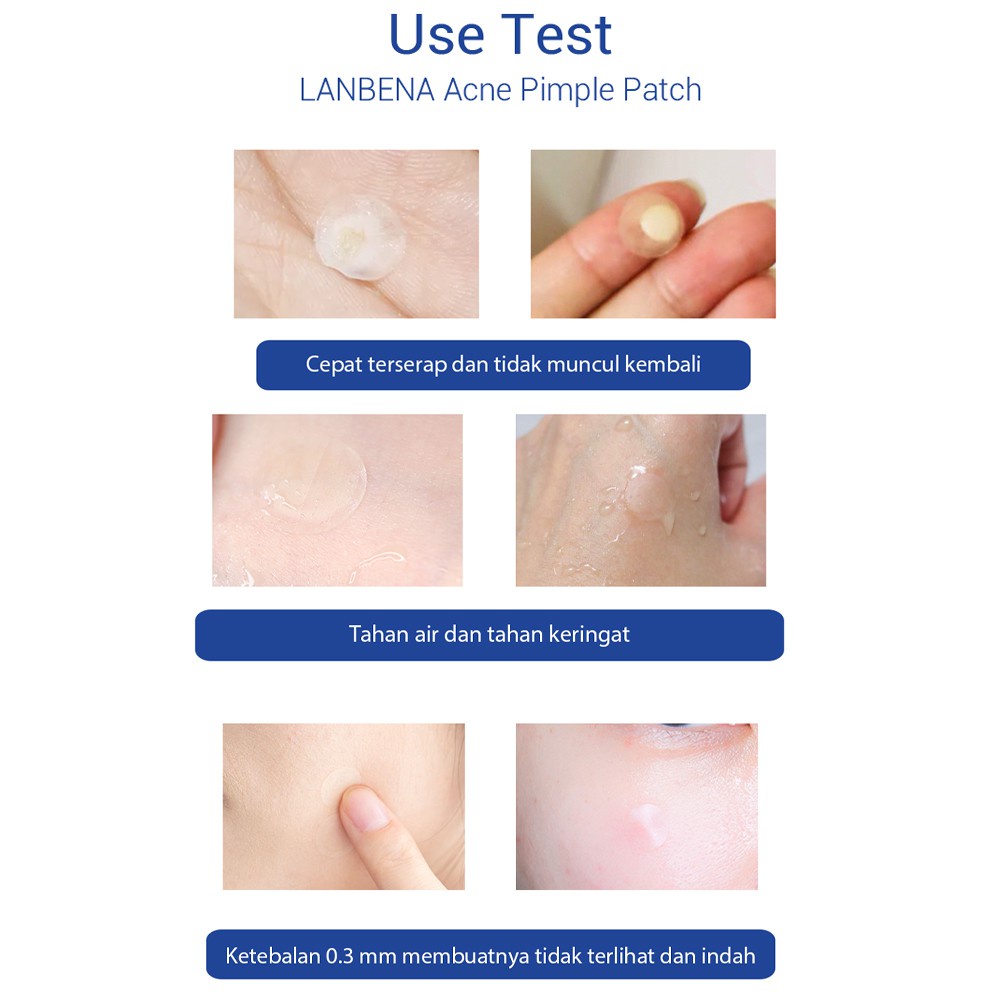 {LB} LANBENA Acne Pimple Patch Masker Invisble Stiker Jerawat