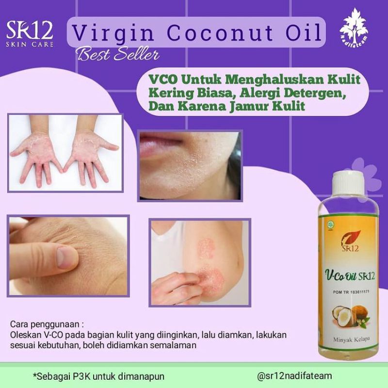 VCO SR12 Untuk Bayi VCO untuk ruam pada bayi VCO Oil Original BPOM