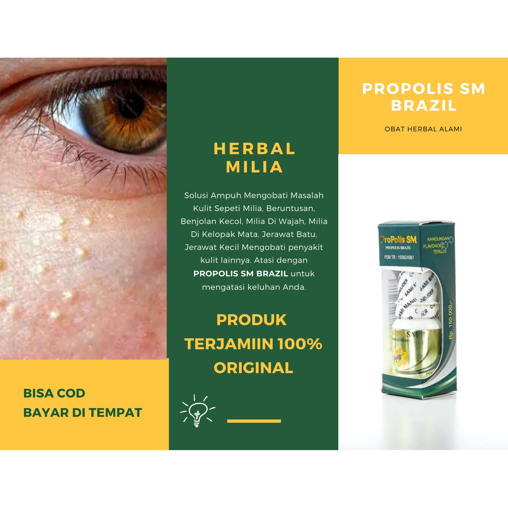 Obat Oles Penghilang Milia - Obat Penghilang Milia, Benjolan Kecil Putih - Propolis Brazil SM Herbal