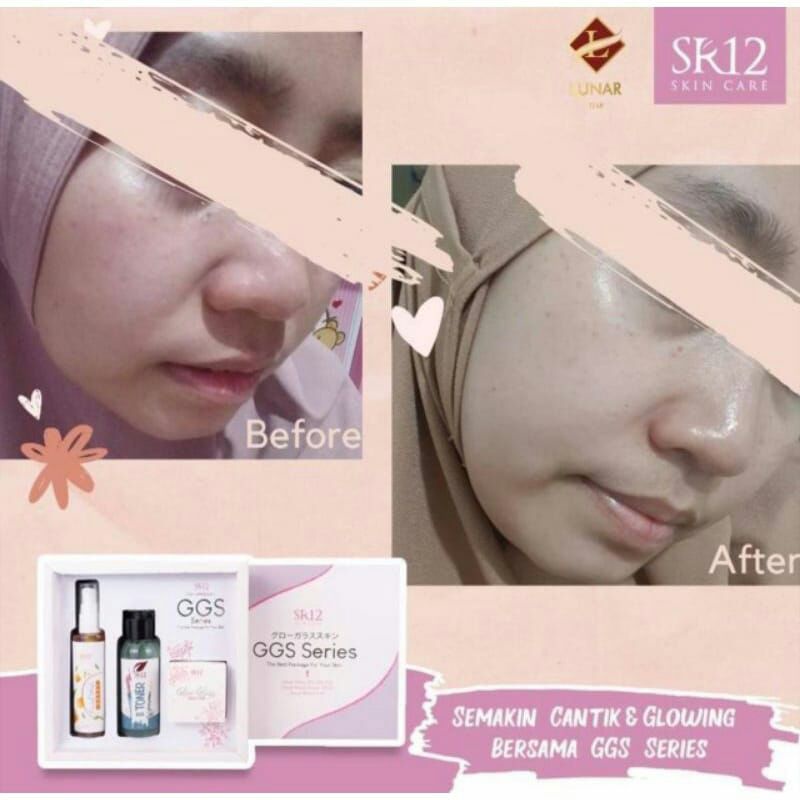 GGS SERIES SR12 // PAKET SKINCRE GLOWING // SKINCARE ALA KOREA // SKINCARE HERBAL // SKINCARE BPOM /