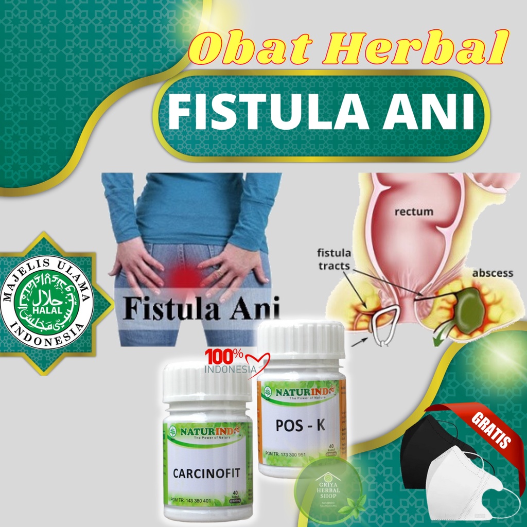 Jual Obat Fistula Ani Obat Bisul Di Pantat Obat Bisul Ampuh Vistula Obat Abses Anus Obat Wasir 7105