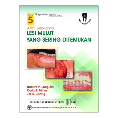 Original Buku Atlas Berwarna Lesi Mulut Yang Sering Ditemukan, Ed. 5