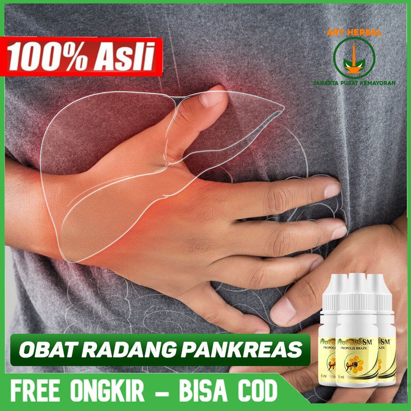 Obat Radang Pankreas, Pankreatitis Akut, Nyeri Bagian Perut Herbal Terlaris Propolis SM Bisa COD