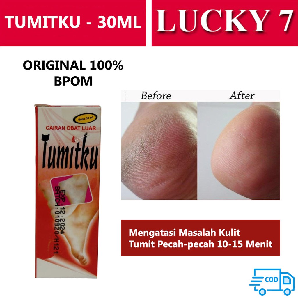 BISA COD - TUMITKU ORIGINAL BPOM - Obat Kapalan Mata Kaki /Tumit - Obat Kaki Pecah2 dan kering Ampuh