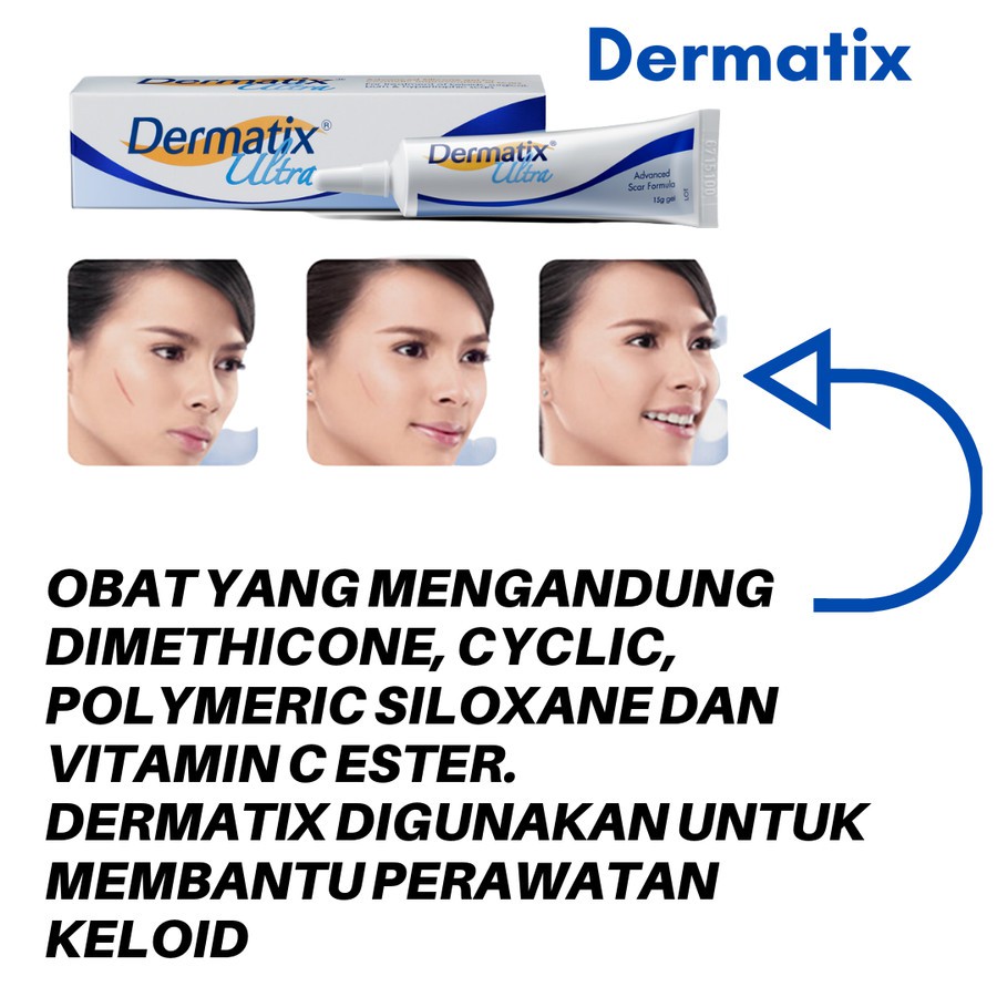 Dermatix Ultra Penghilang Bekas Luka 15 gram Original Dermatik penghilang bekas luka Strechmark Keloid