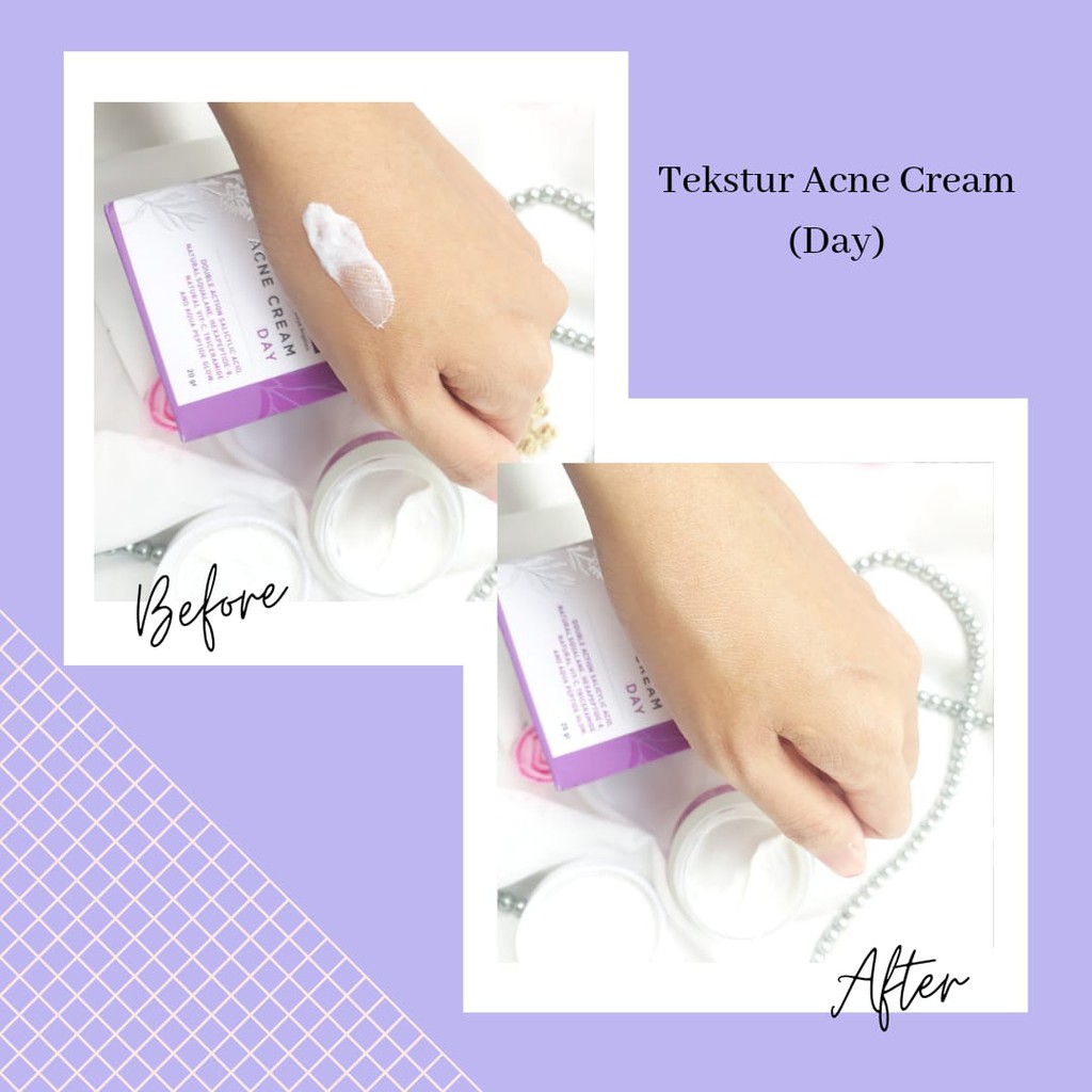 [COD] PAKET 3in1 PERAWATAN WAJAH ANTI JERAWAT SCARLETT | Scarlett Acne Serum+Day &amp; Night Cream ORI