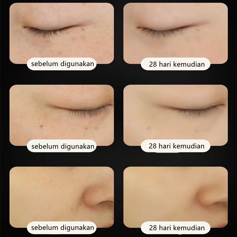 Inface MS6000 Alat Pijat Wajah Elektrik RF Infrared Pencegah Kerutan Detox Anti Aging Skin Care Radio Frekuensi Kecantikan Mesoterapi Elektroporasi Memudar Garis-garis Halus Penghilang Kerut Mengencangkan Menghilangkan Keriput Mencerahkan Meremajakan