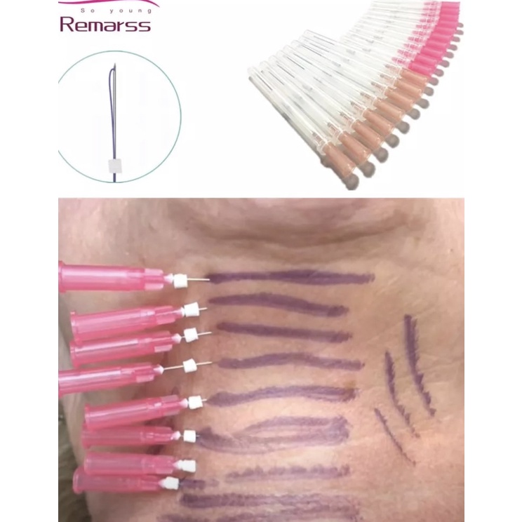 Tanam Benang PDO Screw Tanam Benang PCL Screw Mono Screw Thread Lift Benang Collagen Tanam Benang Wajah PDO Cog PCL Mono Tanam Benang Screw Tarik Benang Hapus Keriput