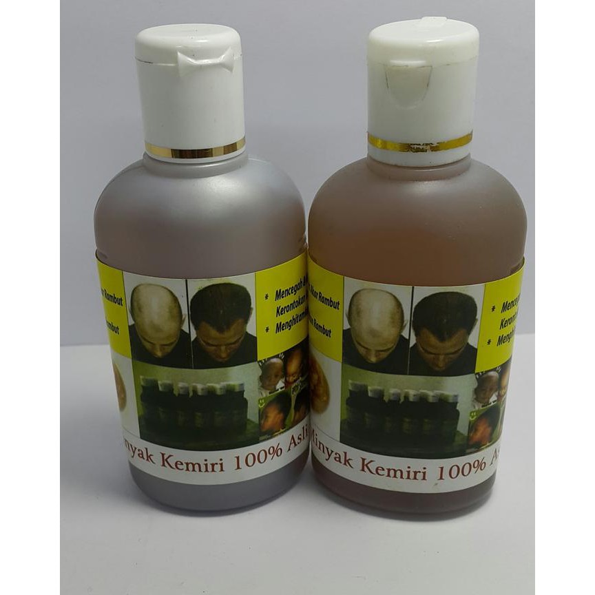 

PROMO!!!!! MINYAK KEMIRI KEPALA BOTAK