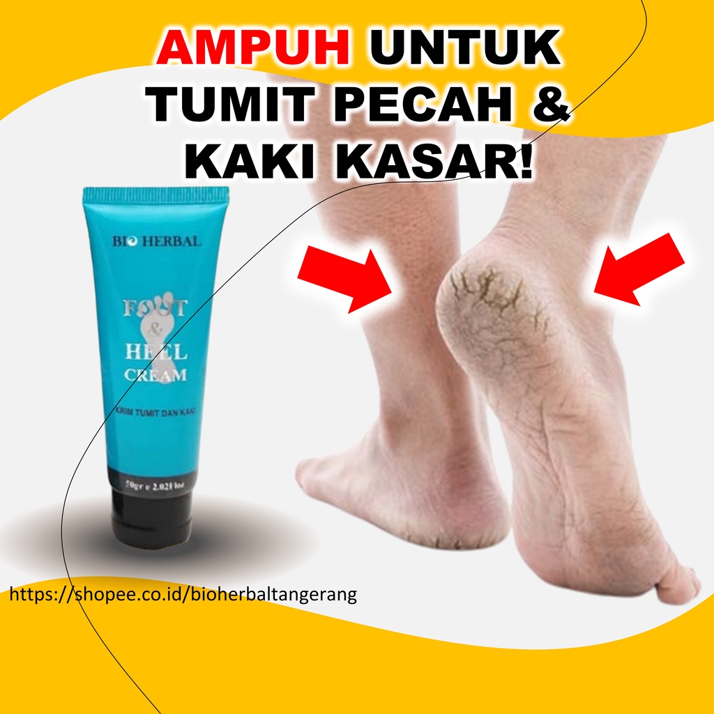 Krim Kaki Pecah Dan Kering Ampuh BPOM B10Q