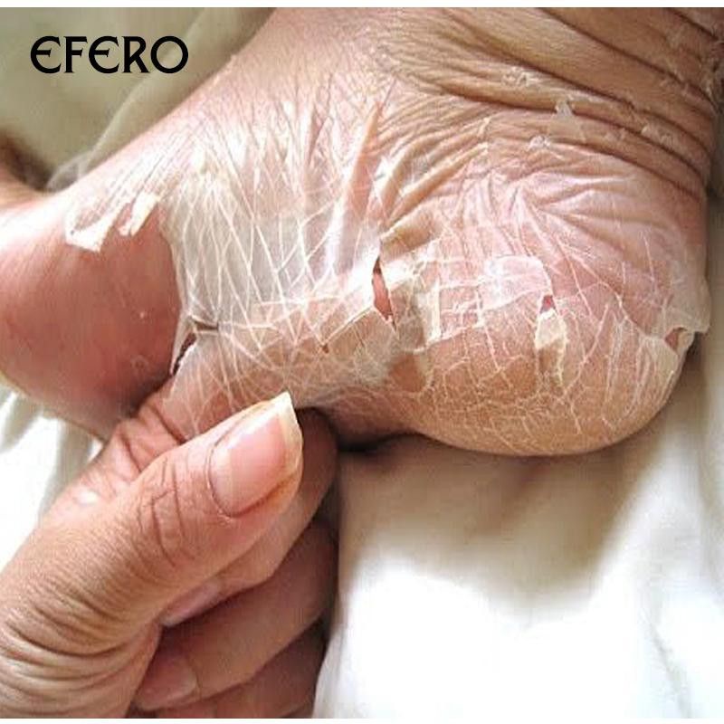 Efero Foot Mask / Masker Kaki Efero / Masker Kaki Merawat Kaki Tumit Kering Pecah-Pecah / Masker Pengelupas Kulit Mati / Efero Exfoliating Foot Mask / Masker Perawatan Kaki / Masker Melembutkan Kaki / Masker Kaki Lavender