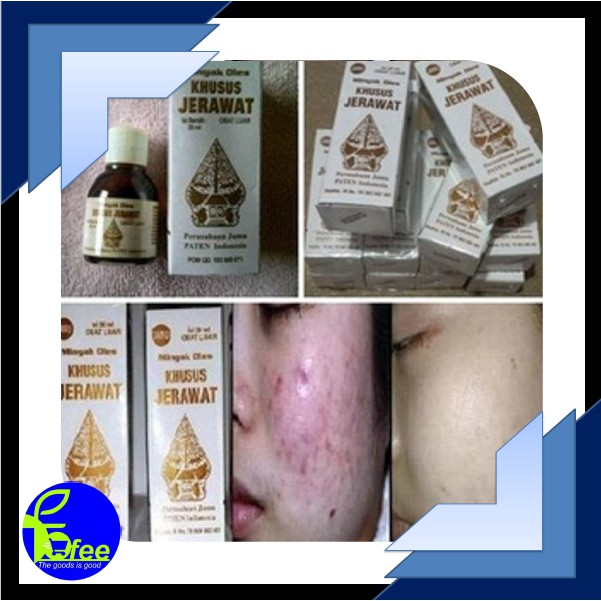 [LOCAL] - Minyak Oles / Serum Wayang Untuk Jerawat BPOM