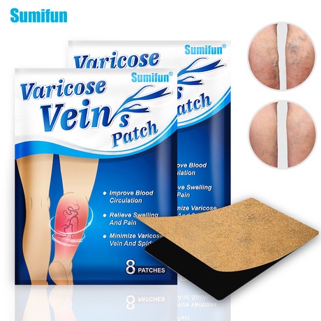 Terbaru Koyo Varises Varicose Veins Herbal Heling Patch