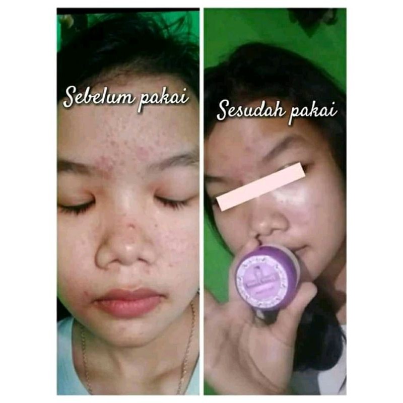 skincare farmasi