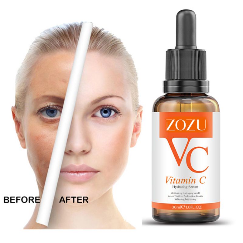 ZOZU Original Serum Vitamin C Whitening Hydro Mositurizing Untuk Kulit Kusam Kering dan Anti Acne