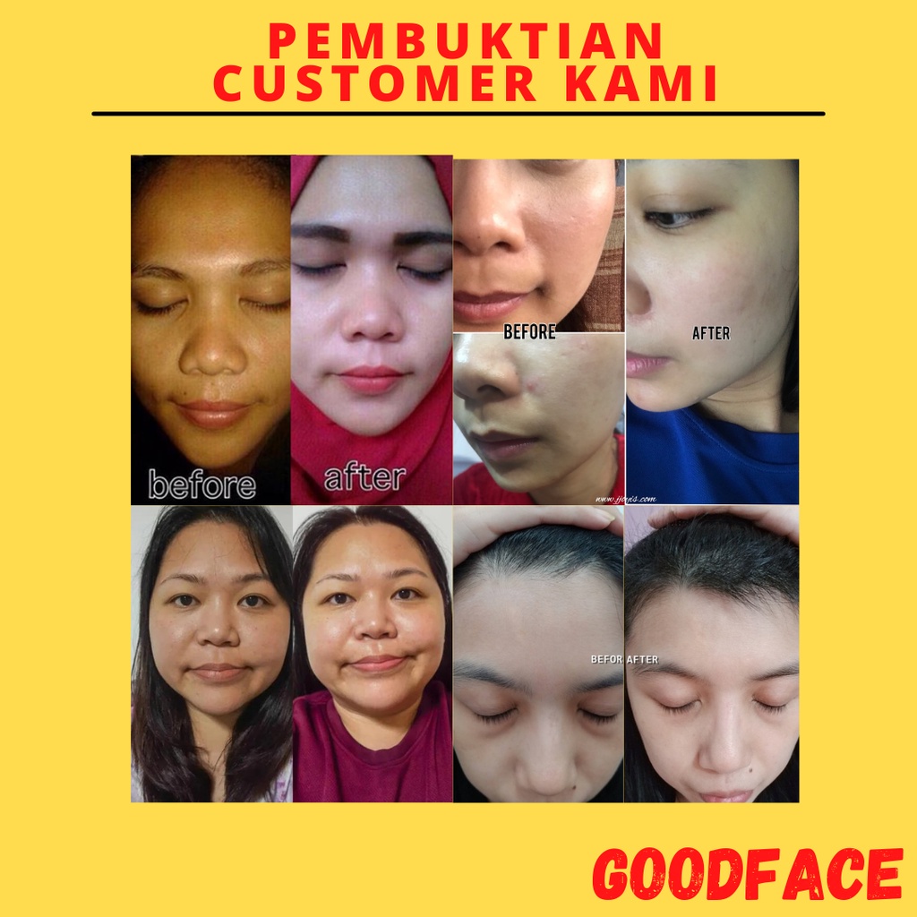 Pelembab Wajah Avoskin YSB Glow Concentrate 2% Alpha Arbutin+Microbiome+Beta Carotene