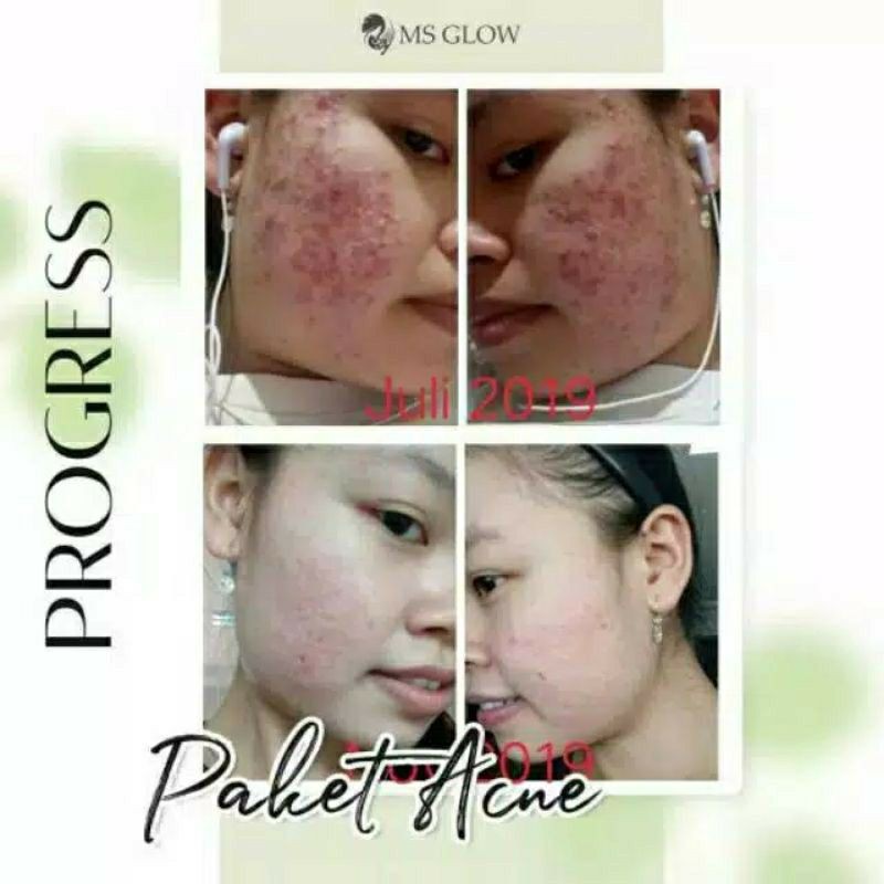 [COD] MS GLOW PAKET WAJAH/+ SERUM [SERUM TERJUAL TERPISAH DARI PAKET WAJAH]