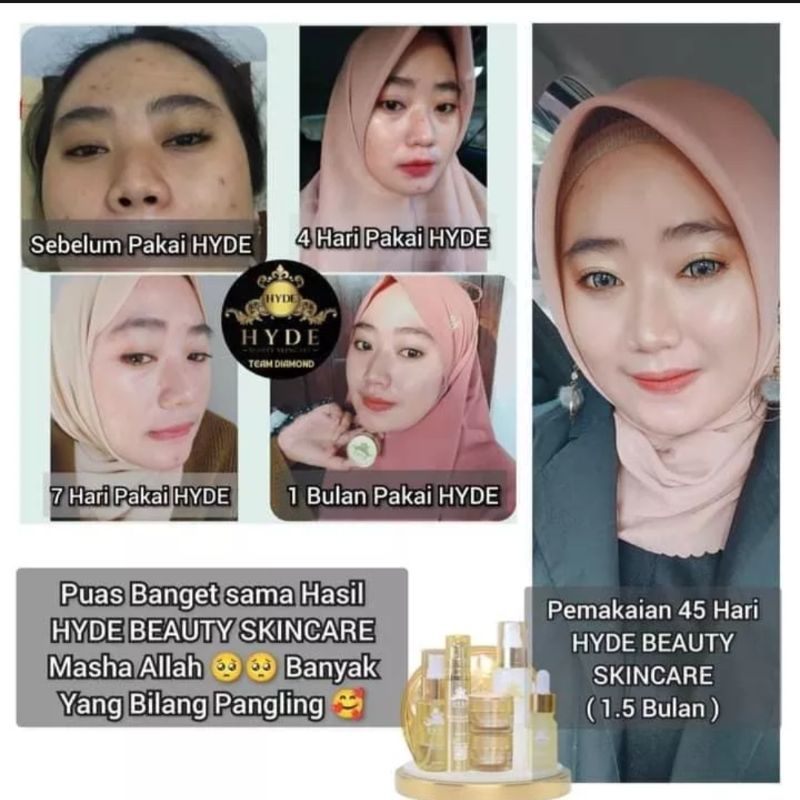 HYDE BEAUTY SKINCARE ORIGINAL ALL VARIANT/ECER ALL VARIANT/ PAKET CREAM GLOWING /ANTI ACNE