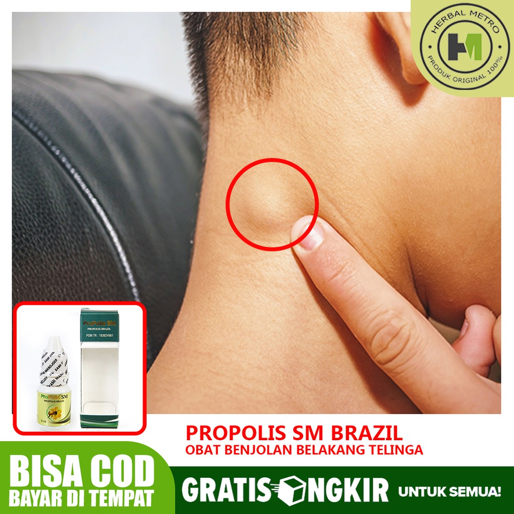 Obat Kelenjar Getah Bening Pembekakan Di Leher Ketiak Belakang Telinga Propolis Sm Shopee Indonesia