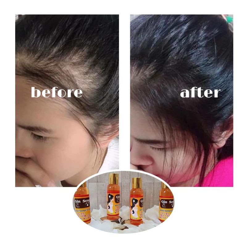 Hair Tonic Red Ginseng Korea Penumbuh Rambut