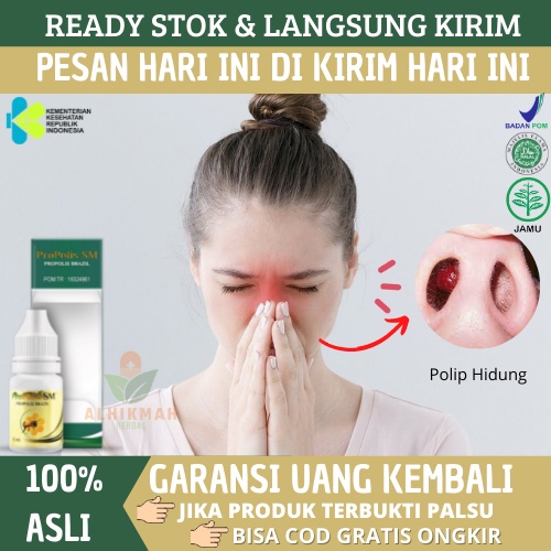 Obat Polip Hidung, Obat Sinusitis, Flu Menahun, Sinusitis Menahun, Obat Benjolan Di Dalam Hidung, Ob