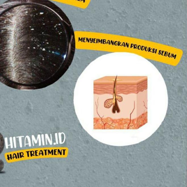 ֍ HITAMIN.ID ATASI RAMBUT RONTOK KUSAM KETOMBE BERLEBIH KULIT KERING UBAN 100% SAMPO ORIGINAL ❉