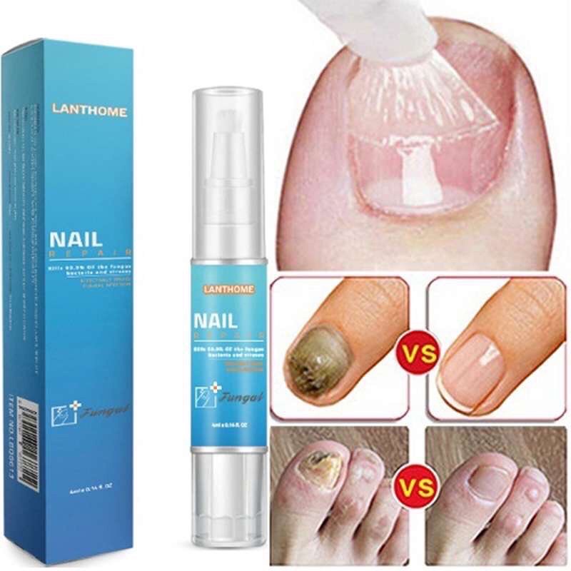 VITAMIN KUKU - NAIL REPAIR TREATMENT LANTHOME