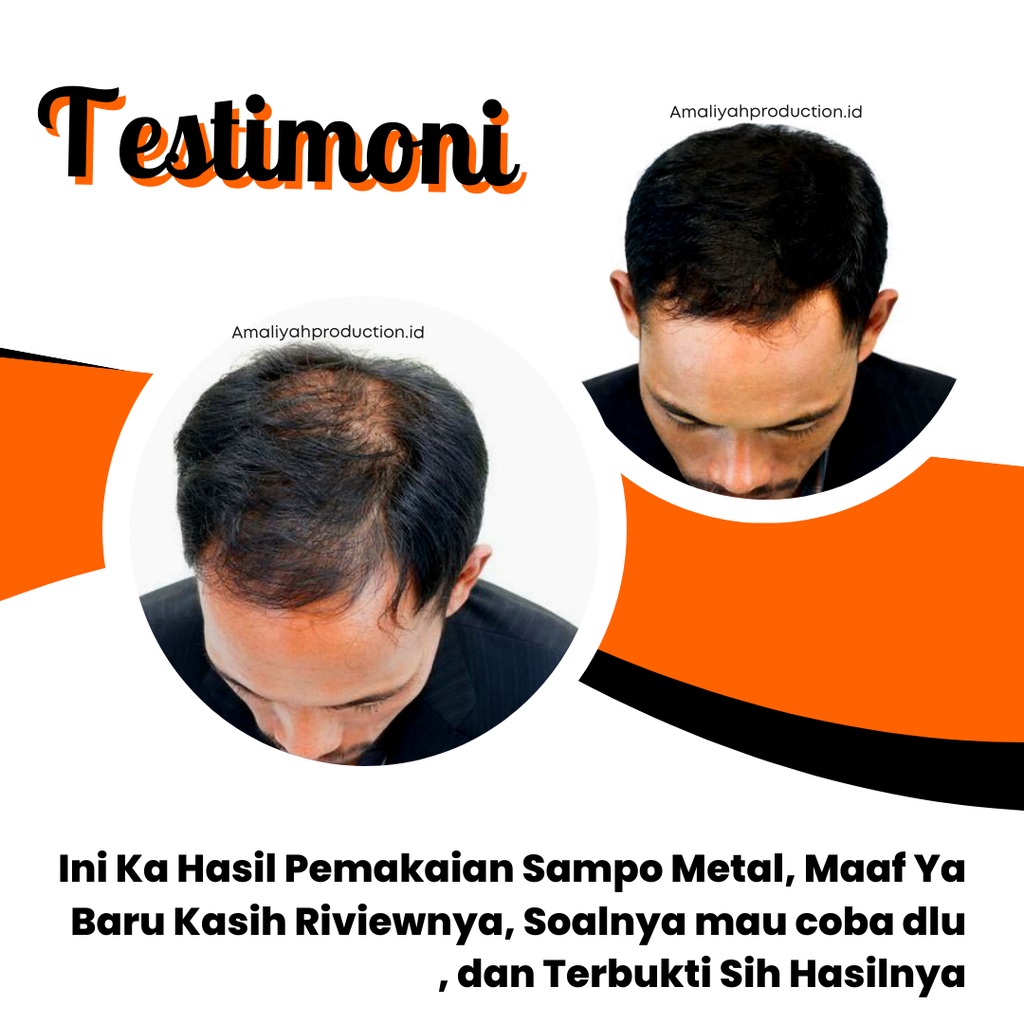 Shampo Pelurus Rambut Permanen Tanpa Catok Obat Penumbuh Rambut Lebat Cepat Pemanjang Shampoo Metal Fortis Longlife Original