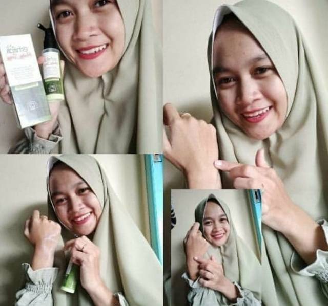 Peeling Spray(Perontok daki/sel kulit mati)