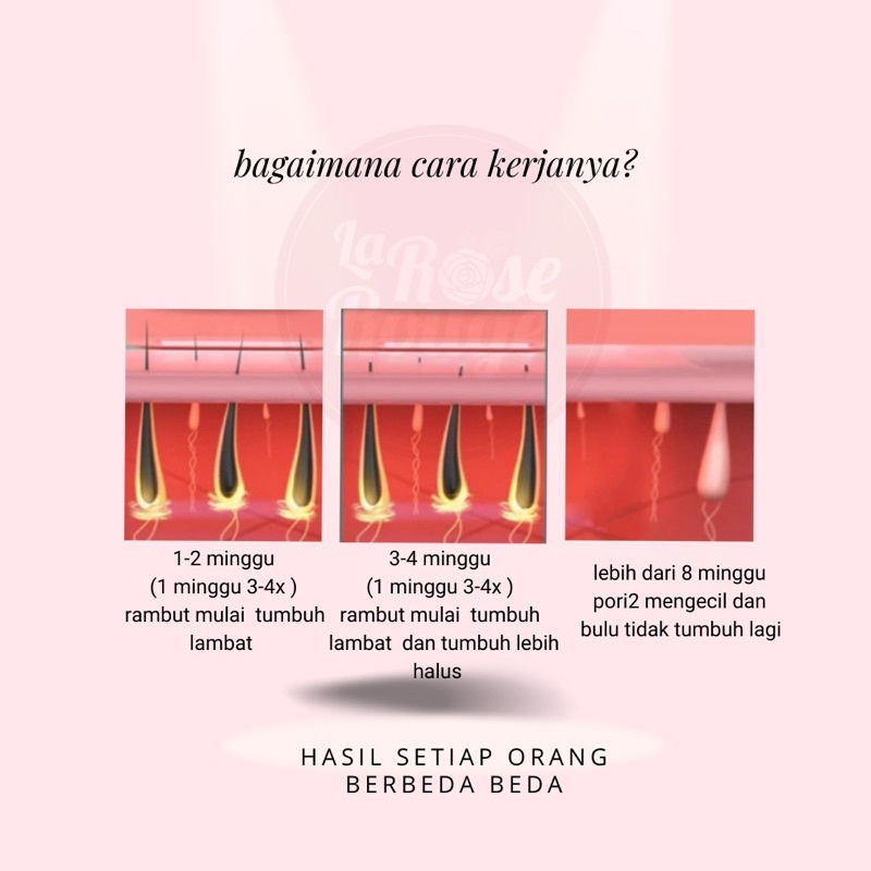 IPL ALAT PENGHILANG BULU PERMANEN / IPL HAIR REMOVAL TANPA SAKIT