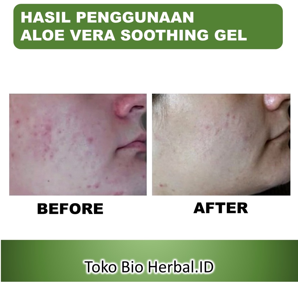 Aloe Vera Gel Lidah Buaya Pelembab Wajah Bibir Dan Kulit Kering B7Q