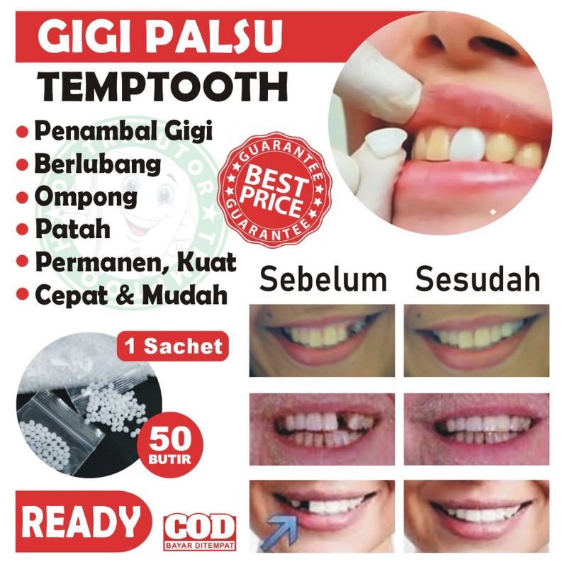 GIGI PALSU SEMENTARA  HARGA 50 BUTIR / PENAMBAL GIGI PATAH RENGGANG TEMPORARY TOOTH TEMPTOOTH GINGSUL PATAH KELINCI