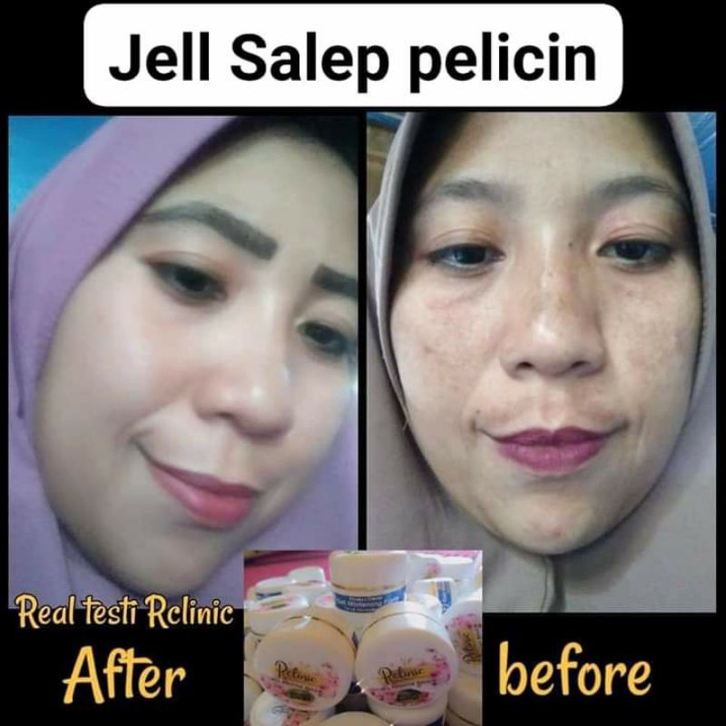 SALEP PELICIN WAJAH GLOWING (RCLINIC DOKTER)