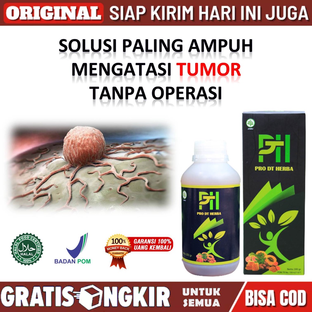 Obat Tumor Ganas - Obat Tumor Otak - Obat Tumor Jaringan Syaraf - Obat Tumor Payudara Paling Ampuh -