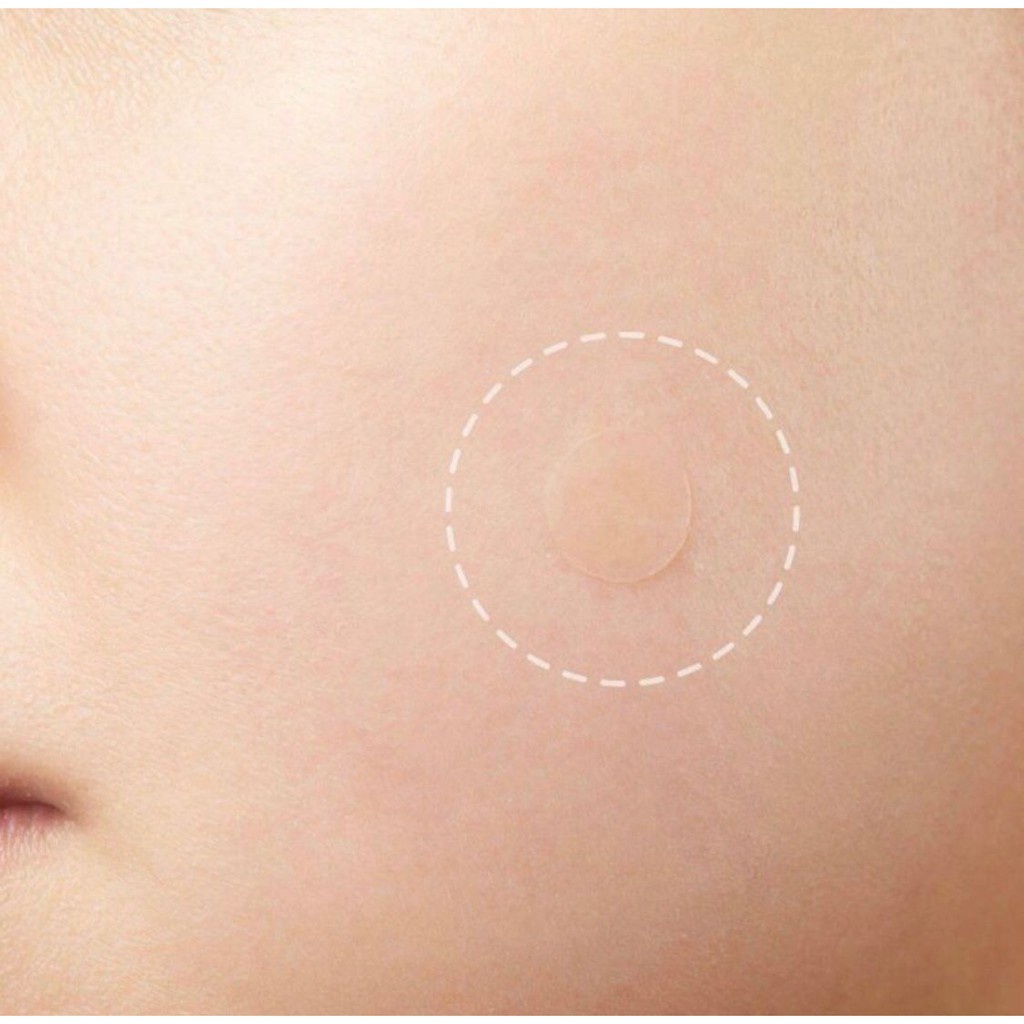 Acne Patch Pimple Blemish Removal Stickers Breathable Pimple Blemish Removal Sticker Facial Care 36 patches Acne Pimple