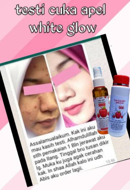 Toner Cuka Apel White Glow Indonesia